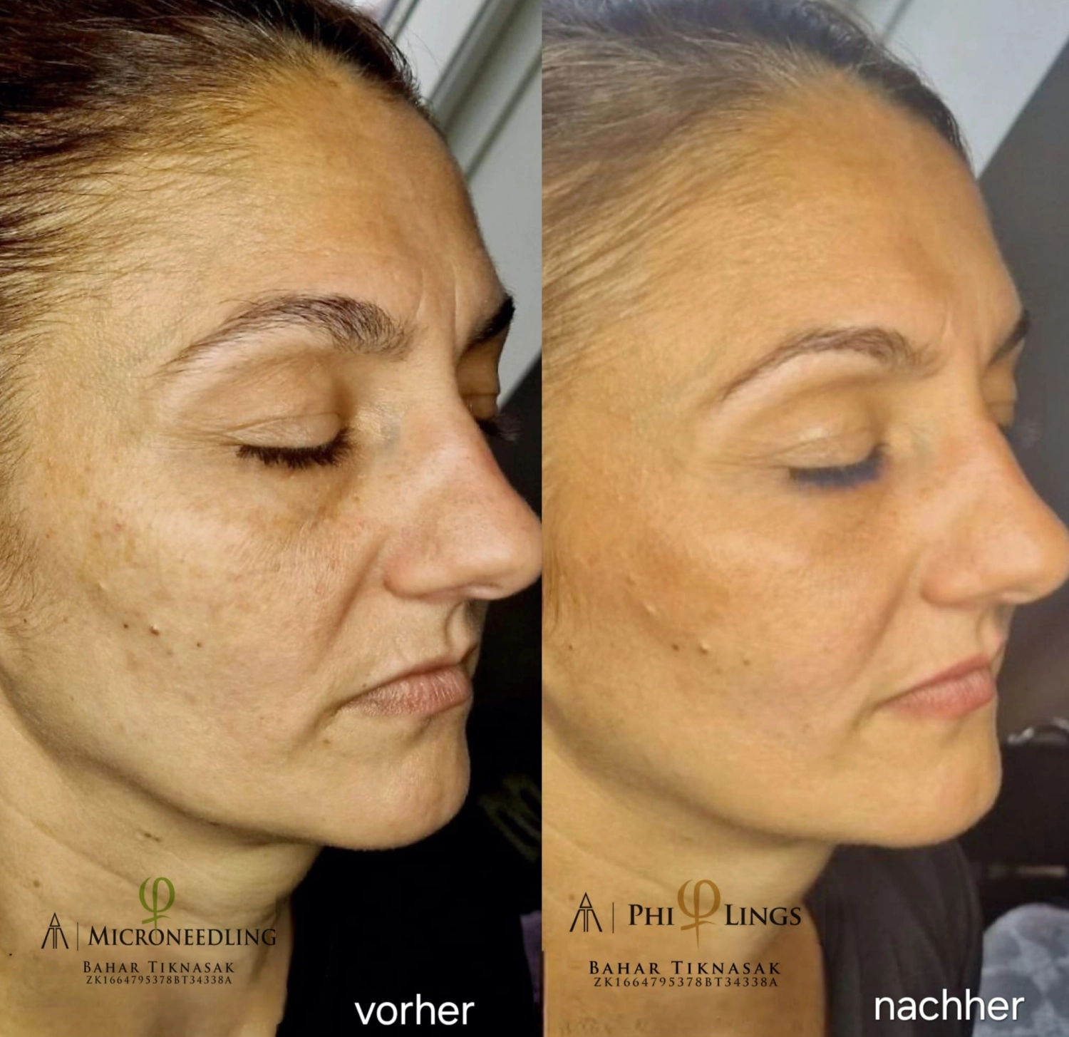 Vorher / Nachher  von Beauty-byBahar