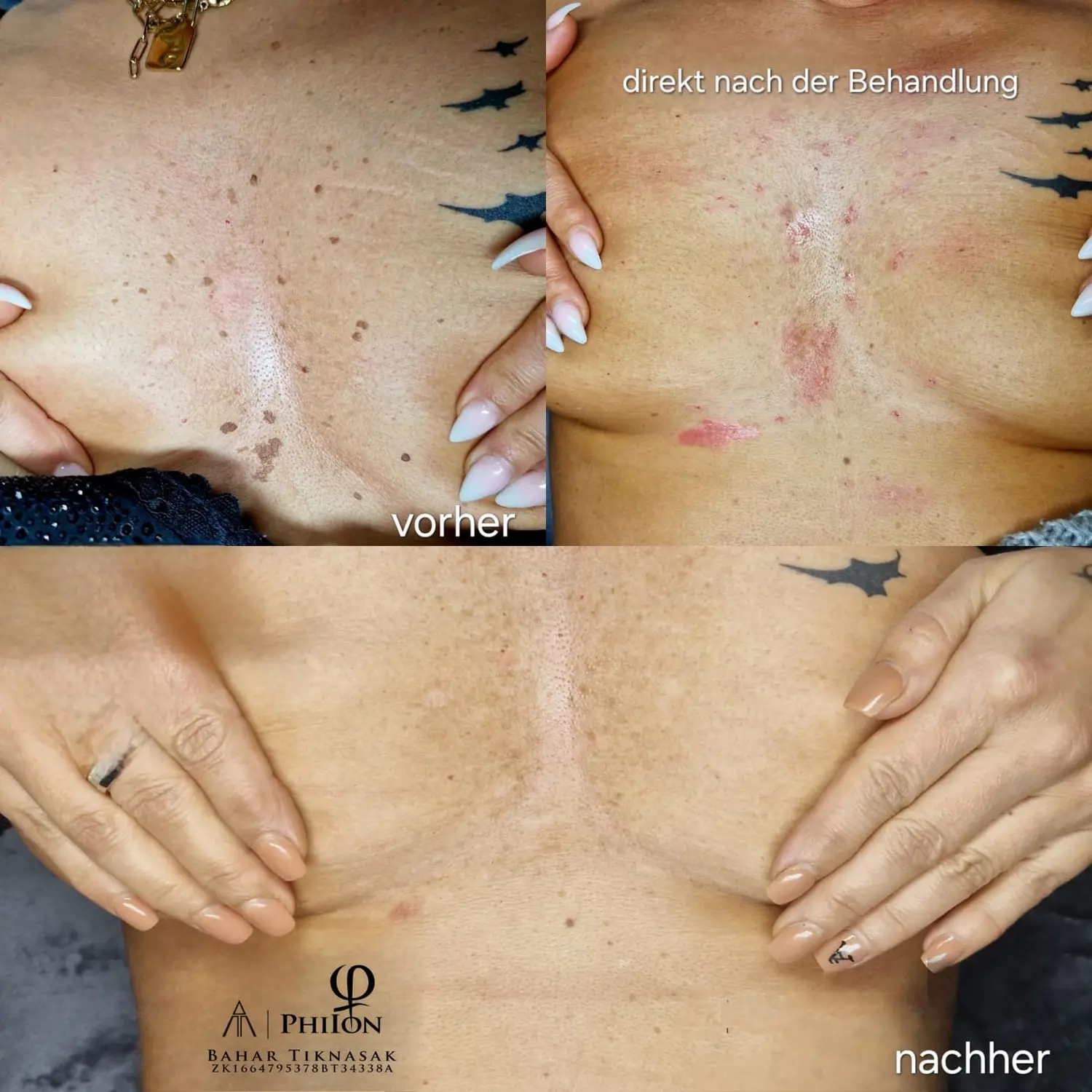 Vorher / Nachher  von Beauty-byBahar