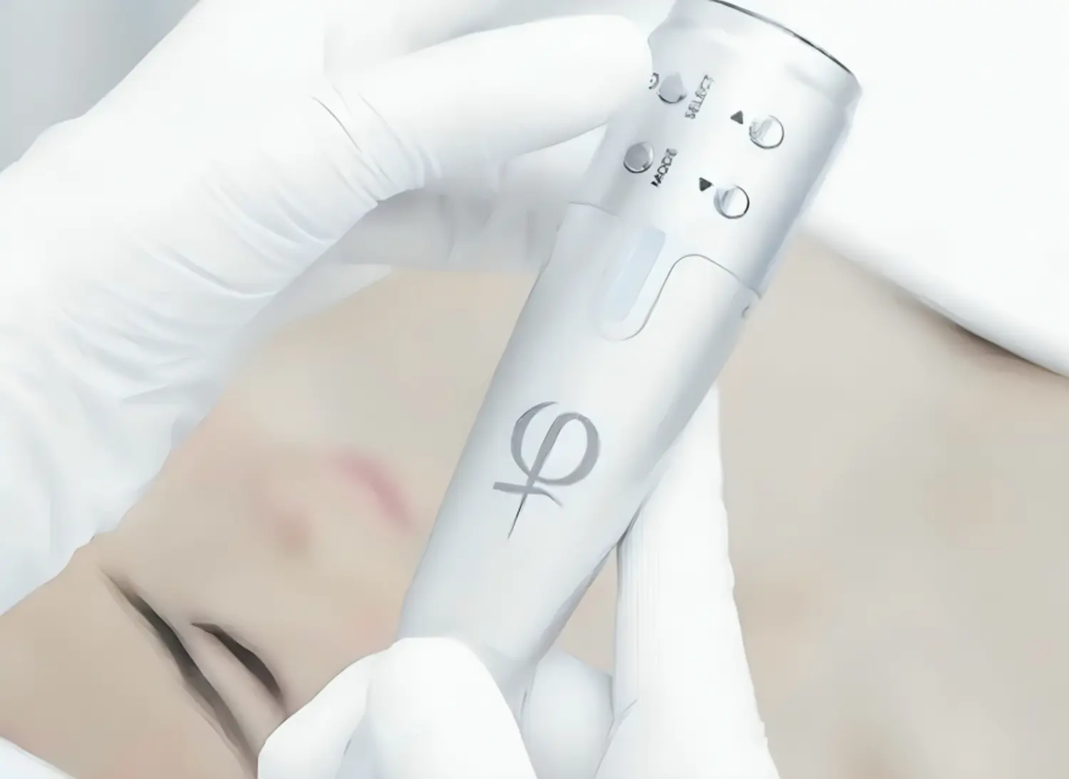 Plasma Pen von Beauty-byBahar